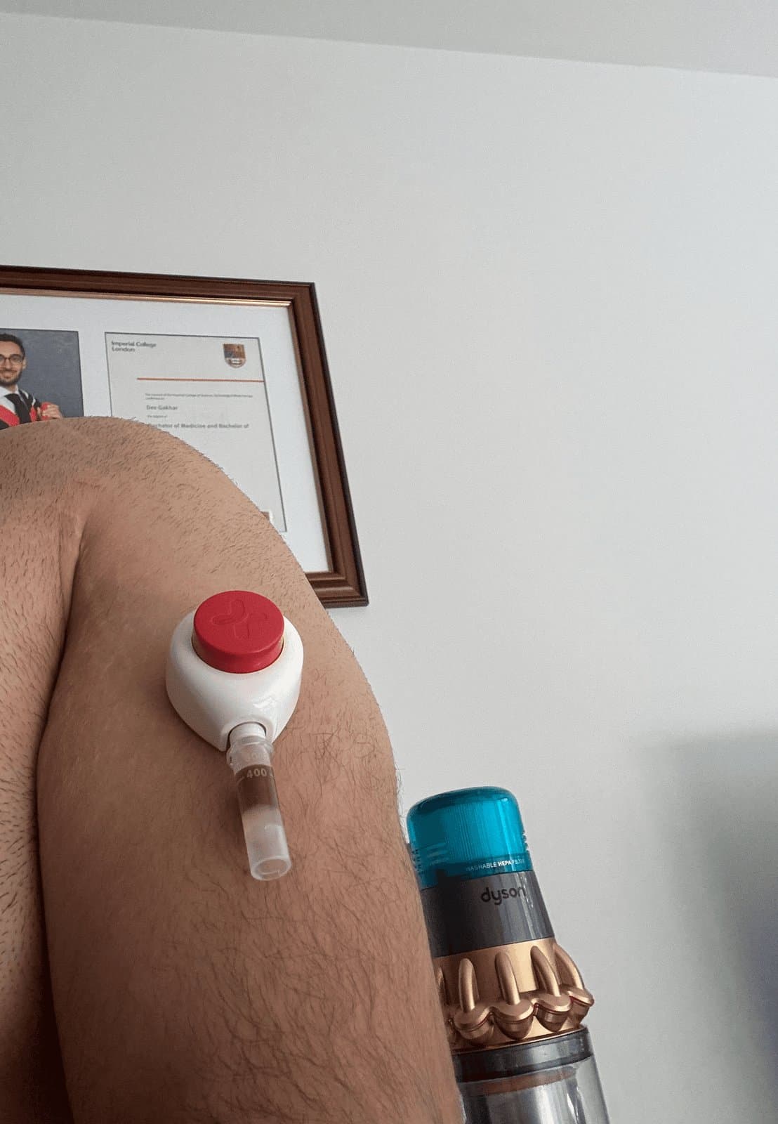 An at-home blood test being taken on an upper arm